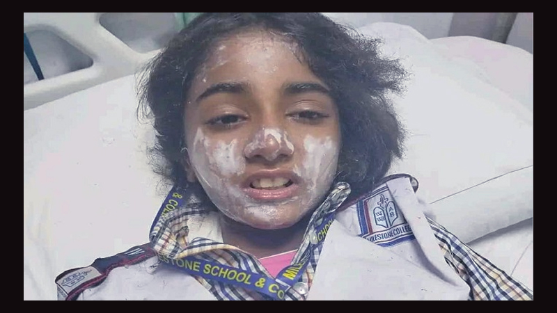 অর্ধেক ঠিকানা ছাড়া কিছুই বলতে পারছে না আহত ছোট্ট রাফিয়া